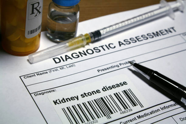 istock Kidney stone disease treatment 1142092615