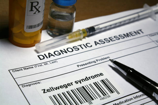 istock Zellweger syndrome treatment 1142092679