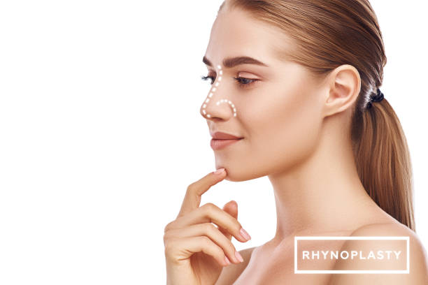 Rhinoplasty - nose surgery. Side view of attractive young woman with perfect skin and dotted lines on her nose isolated on white background. Plastic surgery concept stock photo