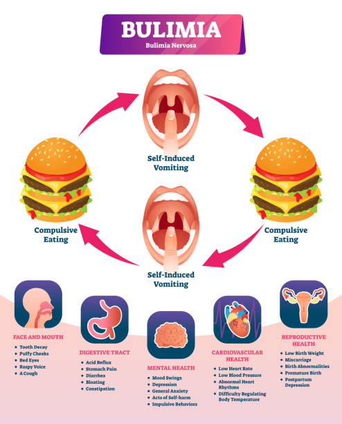 illustrations, cliparts, dessins animés et icônes de illustration vectorielle de boulimia. système de diagnostic de vomissement auto-induit - bulimia