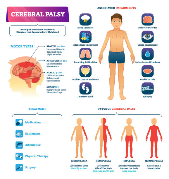 ilustraciones, imágenes clip art, dibujos animados e iconos de stock de ilustración vectorial de parálisis cerebral. esquema de tipo de trastorno de movimiento permanente - cuadriplégico