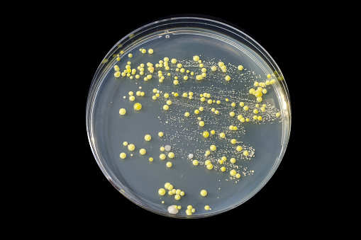 Bacteria grown from skin smear, colonies of Micrococcus luteus and Staphylococcus epidermidis on Petri dish with Tryptic soy agar isolated on black background
