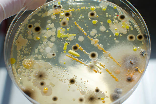 colônias de diferentes bactérias e moldes - media mixed - fotografias e filmes do acervo