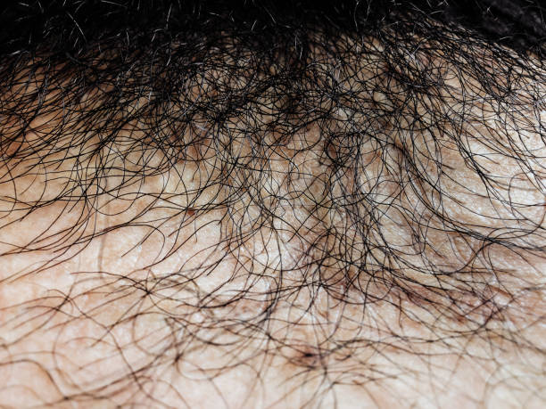 Pubic Hairstyles Stock Photos, Pictures & Royalty-Free Images - iStock Pubic Hairstyles Stock Photos, Pictures & Royalty-Free Images - iStock
