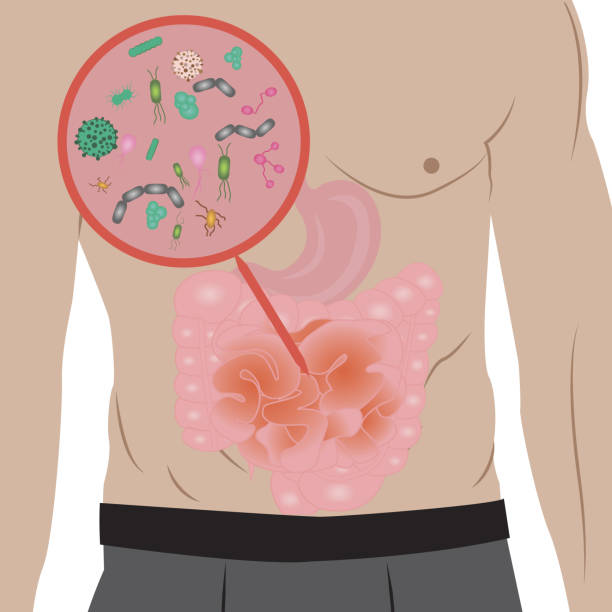 illustrazioni stock, clip art, cartoni animati e icone di tendenza di fermare la crescita troppo dell'infezione nell'illustrazione vettoriale dell'intestino - alimentary