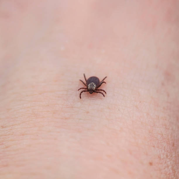 istock dangerous contagious insect a tick crawling on human skin 1142643642