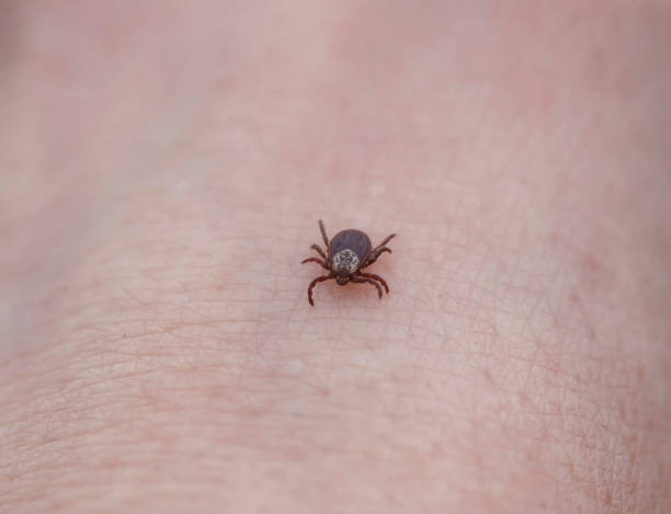 istock dangerous contagious insect a tick crawling on human skin 1142643644