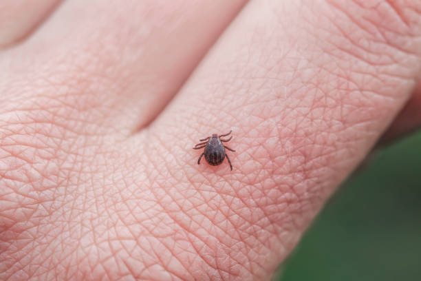 peligroso ácaro de insectos infecciosos se arrastra sobre la piel de la mano humana para chupar la sangre - animal skin fotos fotografías e imágenes de stock