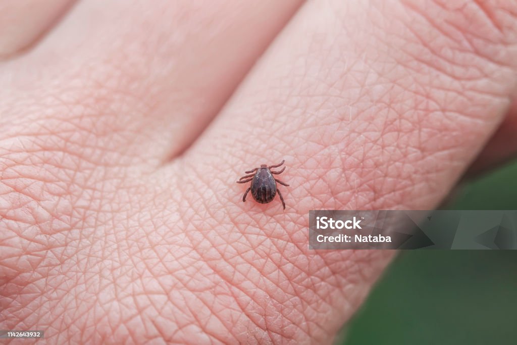 dangerous infectious insect mite crawls on the skin of the human hand to suck the blood dangerous infectious insect mite crawls on the skin of the fingers of the human hand to suck the blood Tick - Animal Stock Photo