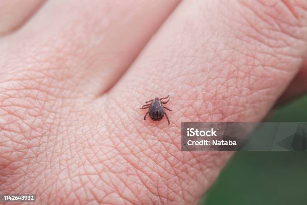 Dangerous Infectious Insect Mite Crawls On The Skin Of The Human Hand To Suck The Blood Stock Photo - Download Image Now