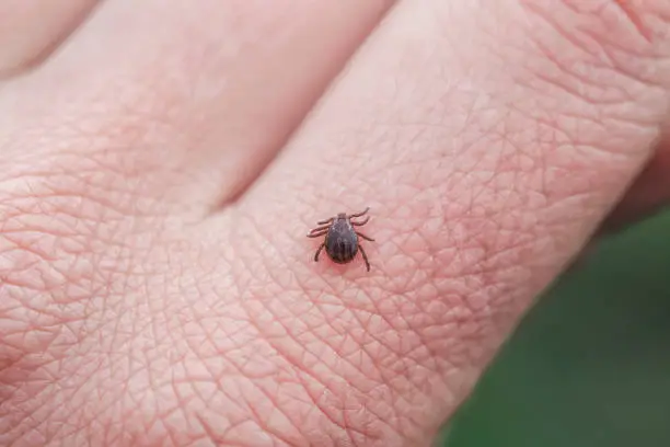 dangerous infectious insect mite crawls on the skin of the fingers of the human hand to suck the blood