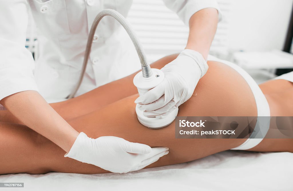Frau mit Kavitationsverfahren, Cellulite-Behandlung, auf ihrem Gesäß und Beinen - Lizenzfrei Zellulitis Stock-Foto
