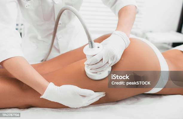 Frau Mit Kavitationsverfahren Cellulitebehandlung Auf Ihrem Gesäß Und Beinen Stockfoto und mehr Bilder von Zellulitis