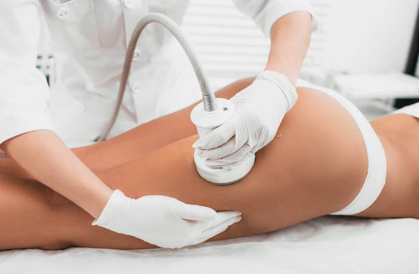 woman having cavitation procedure, cellulite treatment, on her buttocks and legs woman having cavitation, procedure removing cellulite on her buttocks , lifting buttocks cellulite stock pictures, royalty-free photos & images