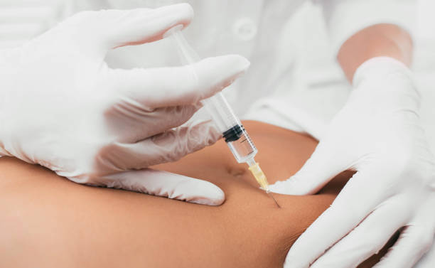 femme obtenant une injection, traitement de la cellulite. méthodes de suppression de la cellulite - mesotherapy photos et images de collection