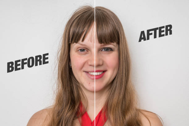 istock Woman face before and after cosmetic makeup 1142824981