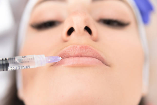 Mesotherapy Treatment On Female Lips Stock Photo - Download Image Now - Botulinum Toxin Injection, One Woman Only, Rocket Booster - iStock