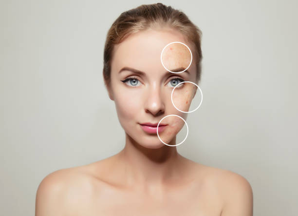 cara de mujer retrato con piel clara y angepinselte - dermis fotografías e imágenes de stock