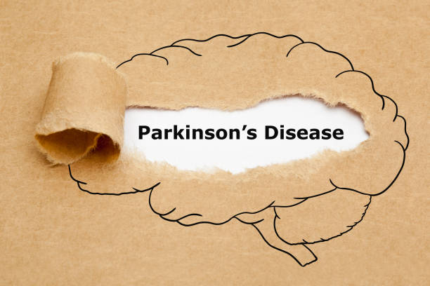Parkinsons Disease Torn Paper Concept Concept with text Parkinsons Disease appearing behind torn brown paper with human brain drawing. parkinsons disease photos stock pictures, royalty-free photos & images