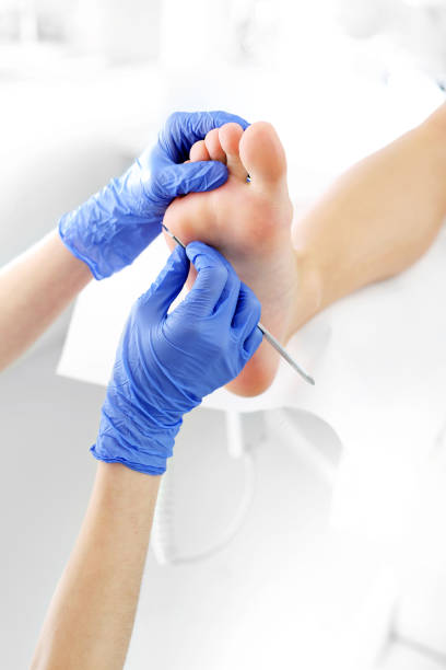 trattamento pedicure - podiatry human foot podiatrist surgery foto e immagini stock