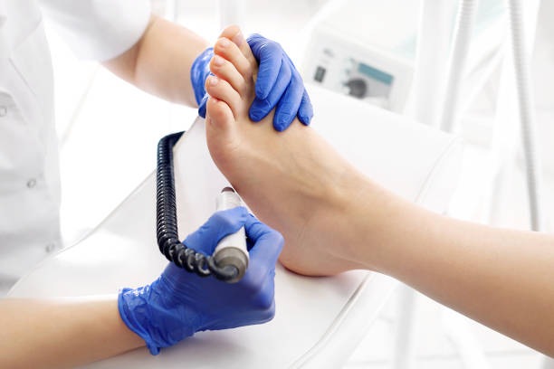 医療ペディキュア。podologist は製粉機で足を開発します。 - podiatrist ストックフォトと画像