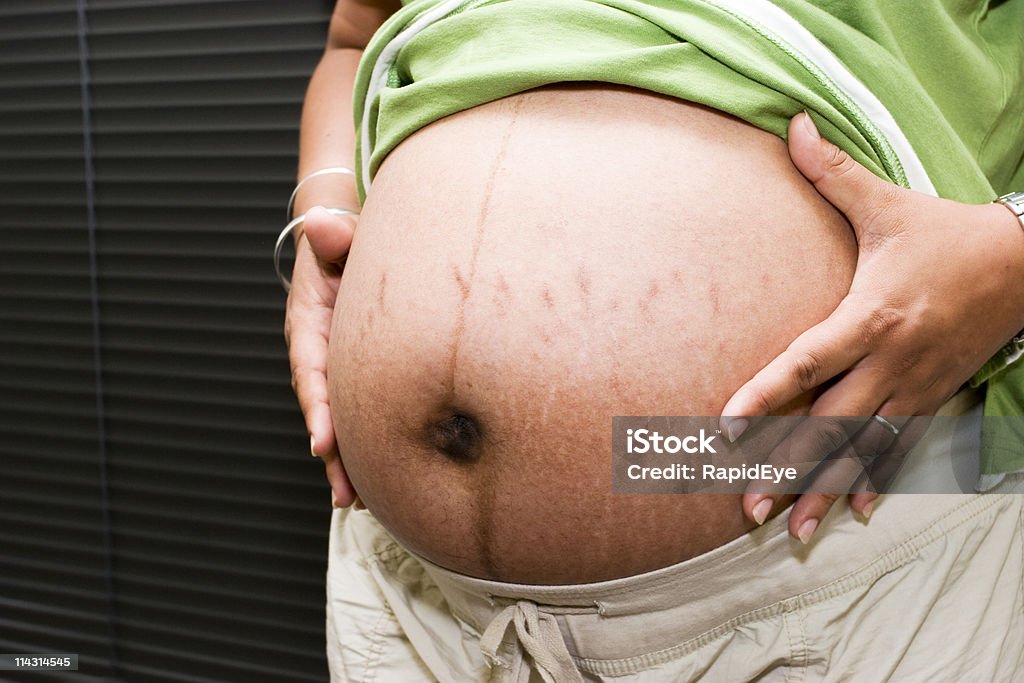 Pregnant with stretch marks  Pregnant Stock Photo