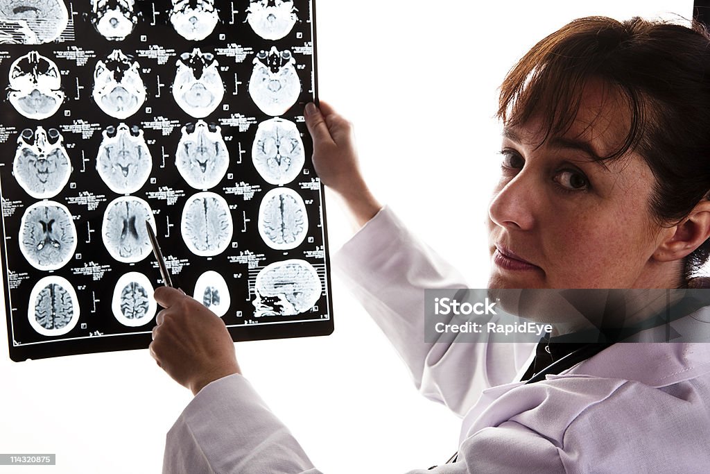 Médico con tomografía cerebral - Foto de stock de Mujeres libre de derechos