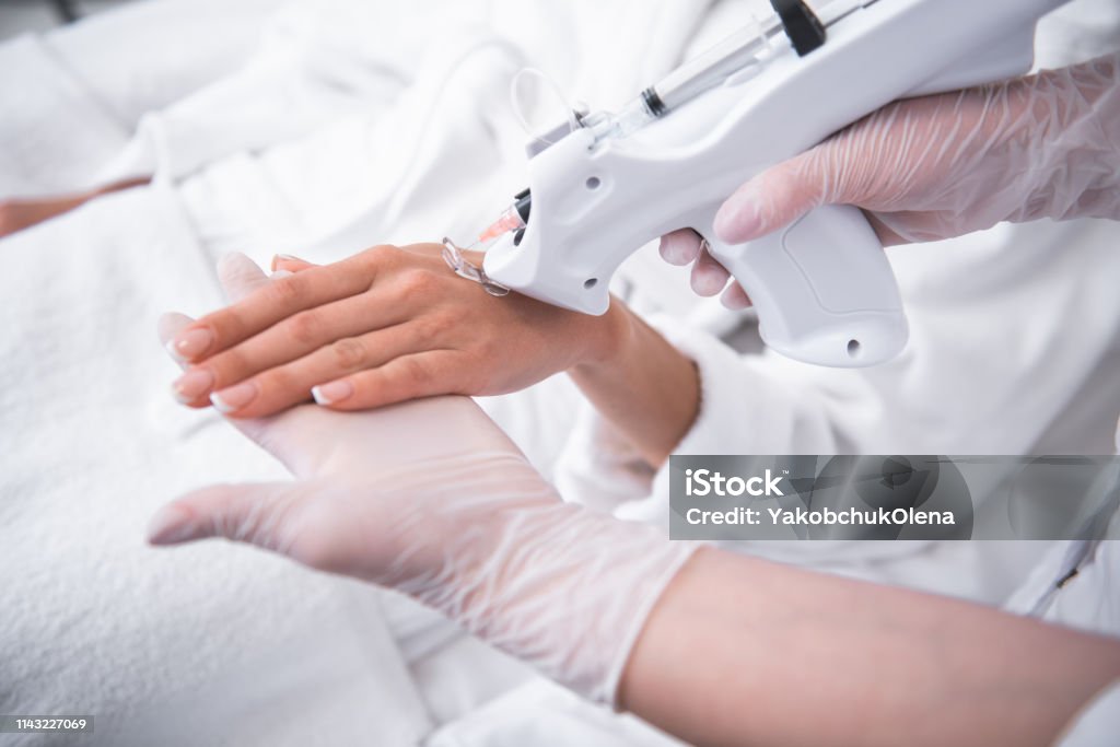 Kosmetologe im sterilen Handschuh macht Injektion in weiblichen Arm - Lizenzfrei Arm - Anatomiebegriff Stock-Foto