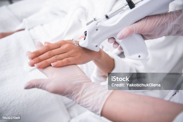 Kosmetologe Im Sterilen Handschuh Macht Injektion In Weiblichen Arm Stockfoto und mehr Bilder von Arm - Anatomiebegriff