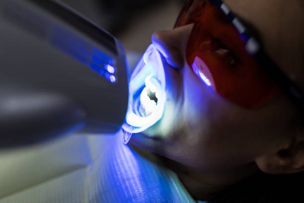 istock Patient with safety protective glasses and cheek retractor on. Laser light lamp turn on as a procedure of Professional Teeth Whitening. 1143366285