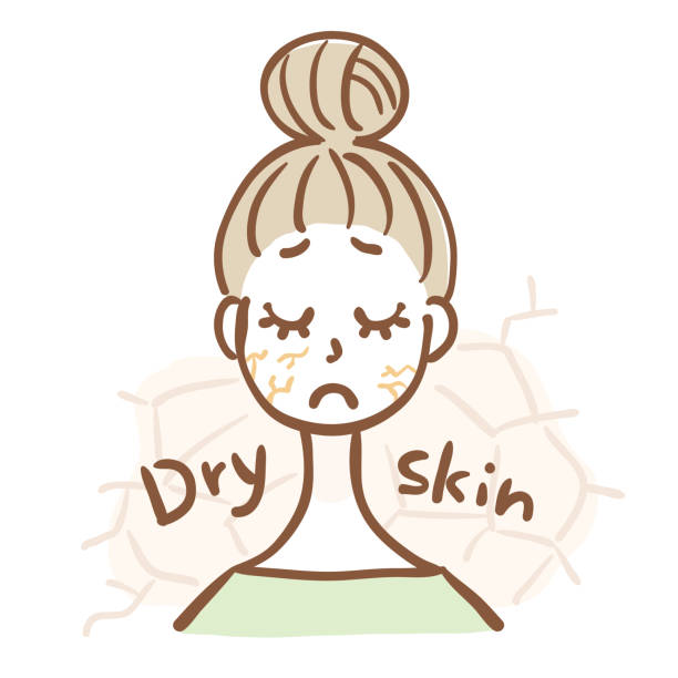 Illustration of a woman with dry skin Illustration of a woman with dry skin dry skin stock illustrations