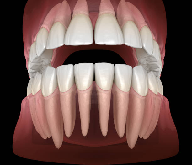 istock Morphology of mandibular and maxillary human gum and teeth. Medically accurate tooth 3D illustration 1143554582