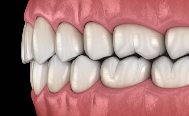istock Healthy human teeth with normal occlusion, side view. Medically accurate tooth 3D illustration 1143554595