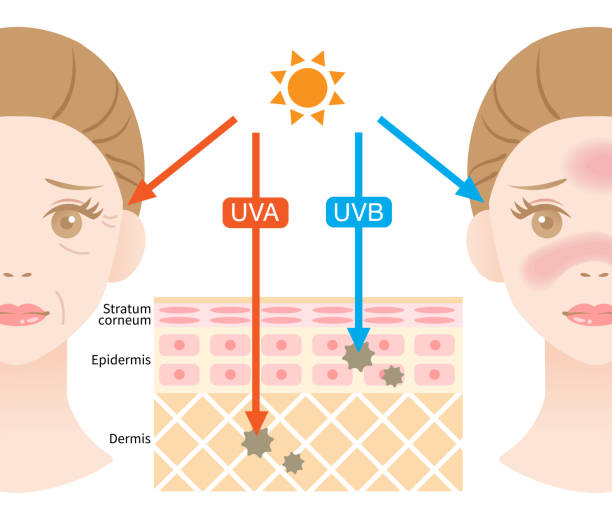 infographic illustration of difference between UVA and UVB rays. UV penetration into human skin and woman face. skin care and beauty concept skin layer illustrationn of UVA rays penetrate deep into the dermis causing winkle. UVB rays damage the epidermis to produce sunburn penetration stock illustrations