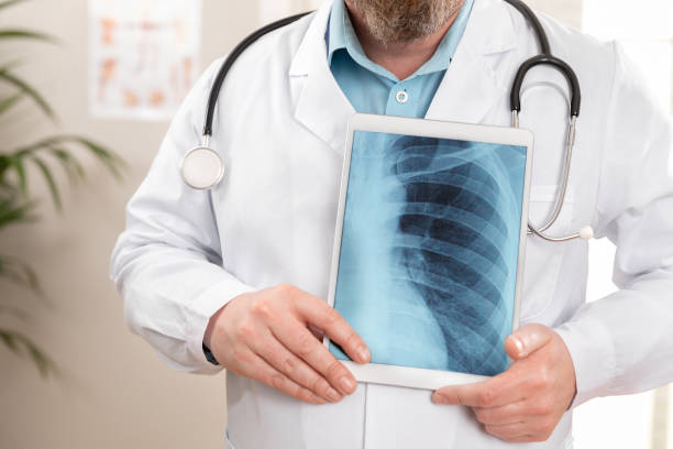 Male doctor showing a digital x-ray image on a tablet Male doctor showing a digital x-ray image on a tablet. Technology in healthcare services. human cardiopulmonary system audio stock pictures, royalty-free photos & images