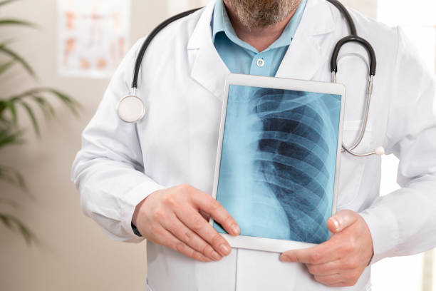 doutor masculino que mostra uma imagem digital do raio x em uma tabuleta - human lung audio - fotografias e filmes do acervo