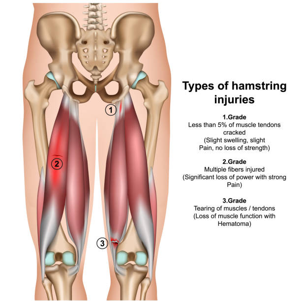 흰색 바탕에 햄 스트링 기이 스 3d 의료 벡터 일러스트 레이 션의 종류 - hip femur ilium pelvis stock illustrations