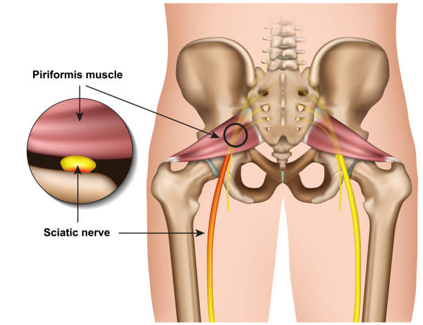 zespół piriformis 3d medyczna ilustracja wektorowa na białym tle - biodro stock illustrations