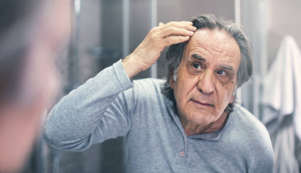 istock Old man is checking hair loss 1143763111