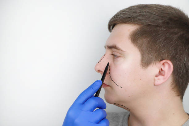 A man at the reception at the plastic surgeon. Before nose surgery, rhinoplasty stock photo