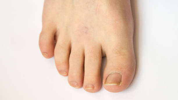 istock Male right foot from above 1144087369