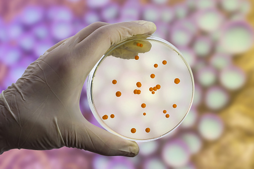 Colonies of bacteria on Petri dish on the bacterial background, photo and 3D illustration
