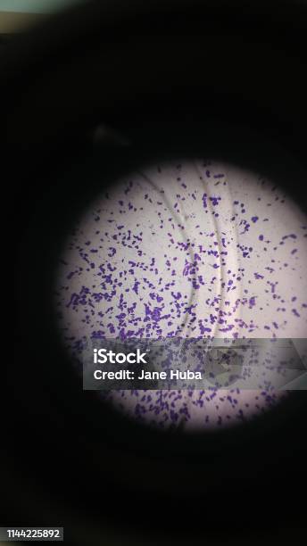 Microscope Purple Human Cells Stock Photo - Download Image Now - AIDS, Animal Blood, Bacterium - iStock Microscope Purple Human Cells Stock Photo - Download Image Now - AIDS, Animal Blood, Bacterium - iStock