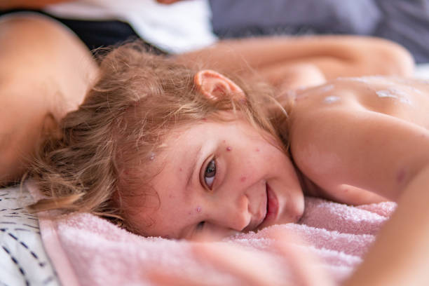 istock Little girl with Chickenpox 1144289794