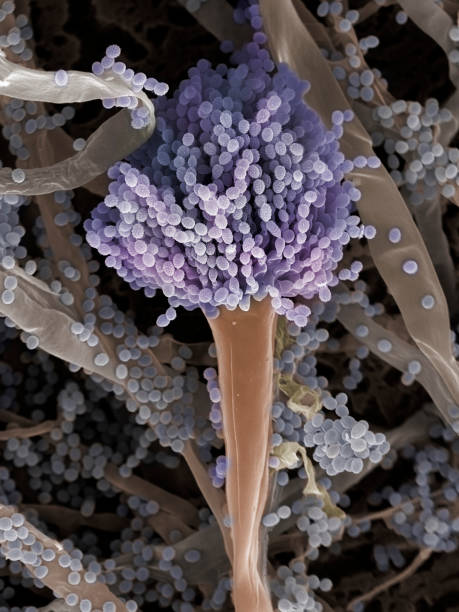 Fungus (Aspergillus fumigatus), SEM Fruiting body (conidiaphore) and hyphae of the fungus Aspergillus fumigatus. A. fumigatus is widely distributed and grows on household dust, soil, and decaying vegetable matter, including stale food, hay and grain. Humans and animals constantly inhale numerous spores of this fungus. A. fumigatus can cause a number of disorders in people with compromised immune function or other lung diseases, including allergy and the serious lung disease aspergillosis. Coloured scanning electron micrograph (SEM), magnified x940 when printed at 10cm wide. conidiophore photos stock pictures, royalty-free photos & images