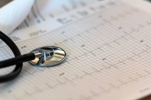 Medical stethoscope on ECG exam graph