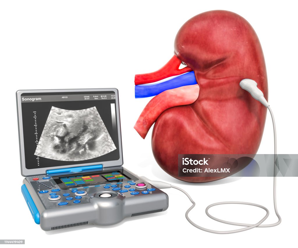 Khái Niệm Siêu Âm Thận Thận Người Với Máy Chẩn Đoán Siêu Âm Y Tế ...