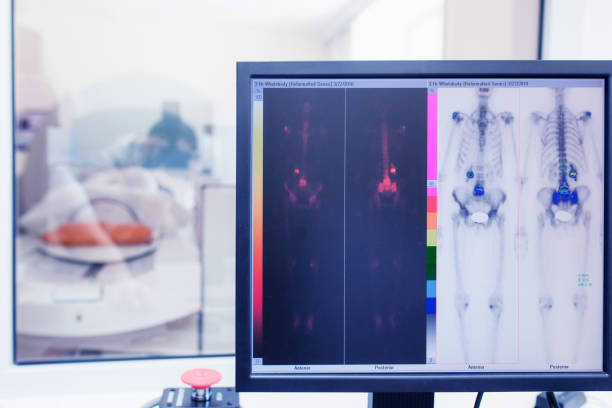 istock isotope study in the laboratory of computed tomography. radioactive study on the detection of bone cancer 1144500123