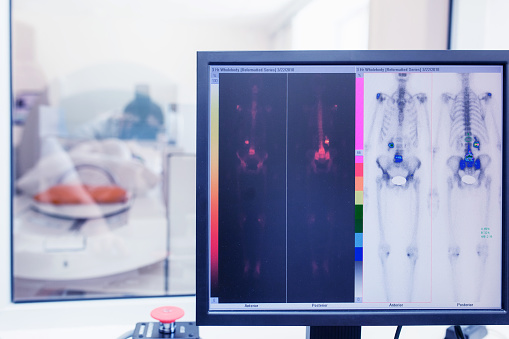 Isotopes Study Isotope Study In The Laboratory Of Computed Tomography Radioactive ...