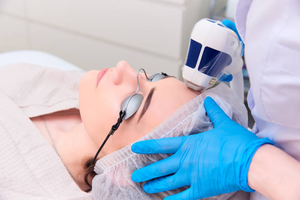procedimento a laser na clínica de cosmetologia a laser. - peeling beauty treatment human face beautician - fotografias e filmes do acervo